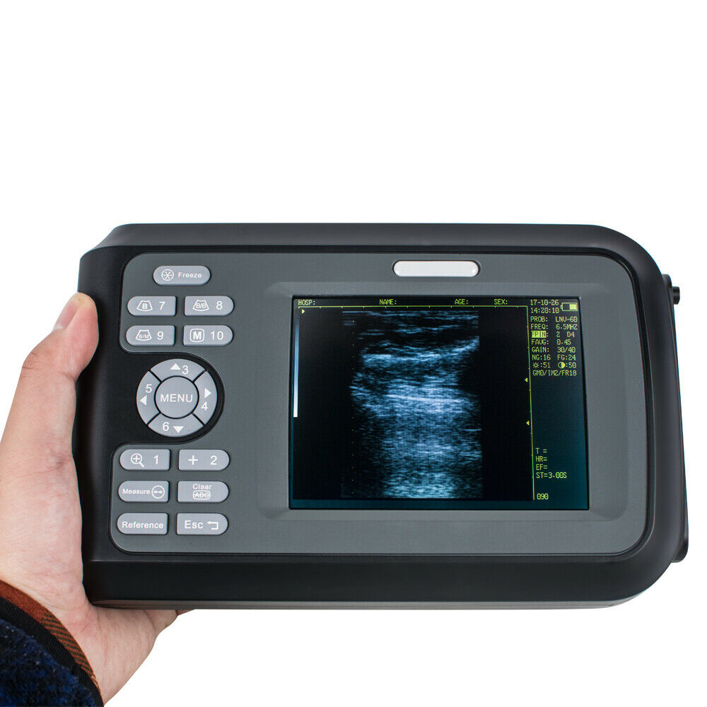 Portable Ultrasonic Ultrasound Scanner/Machine 3.5MHz Convex Probe Veterinary DIAGNOSTIC ULTRASOUND MACHINES FOR SALE