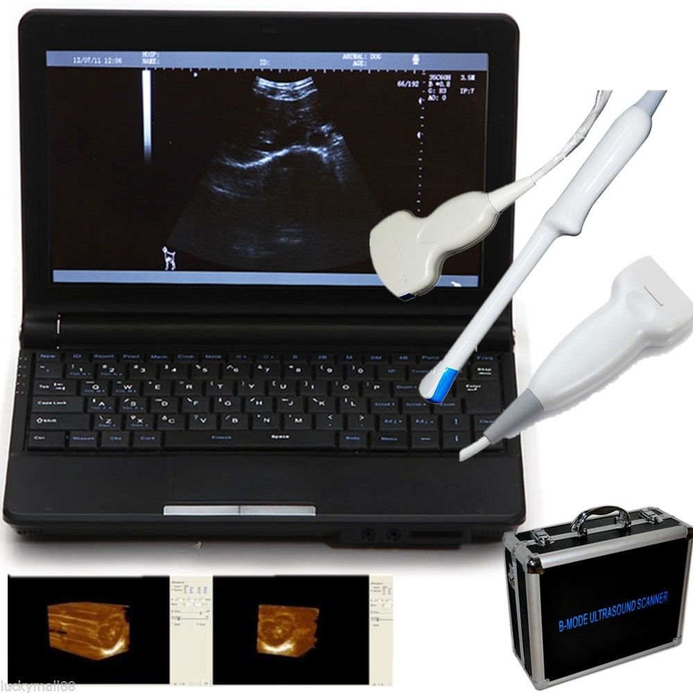 Portable ultrasound scanner machine System + 3 Probes Convex/Linear/Transvaginal 190891666758 DIAGNOSTIC ULTRASOUND MACHINES FOR SALE