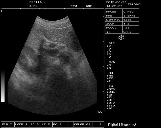 Medical Ultrasound Scanner Machine +7.5Mhz  Linear Probe +3D Software 3 Years w 190891866943 DIAGNOSTIC ULTRASOUND MACHINES FOR SALE