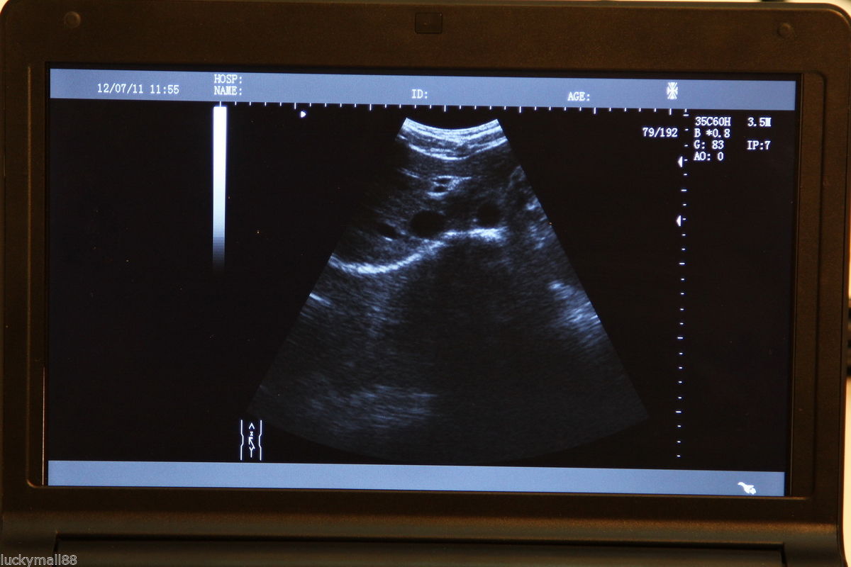 Portable ultrasound scanner laptop machine 3 Probe Convex/Linear/Transvaginal Sy DIAGNOSTIC ULTRASOUND MACHINES FOR SALE