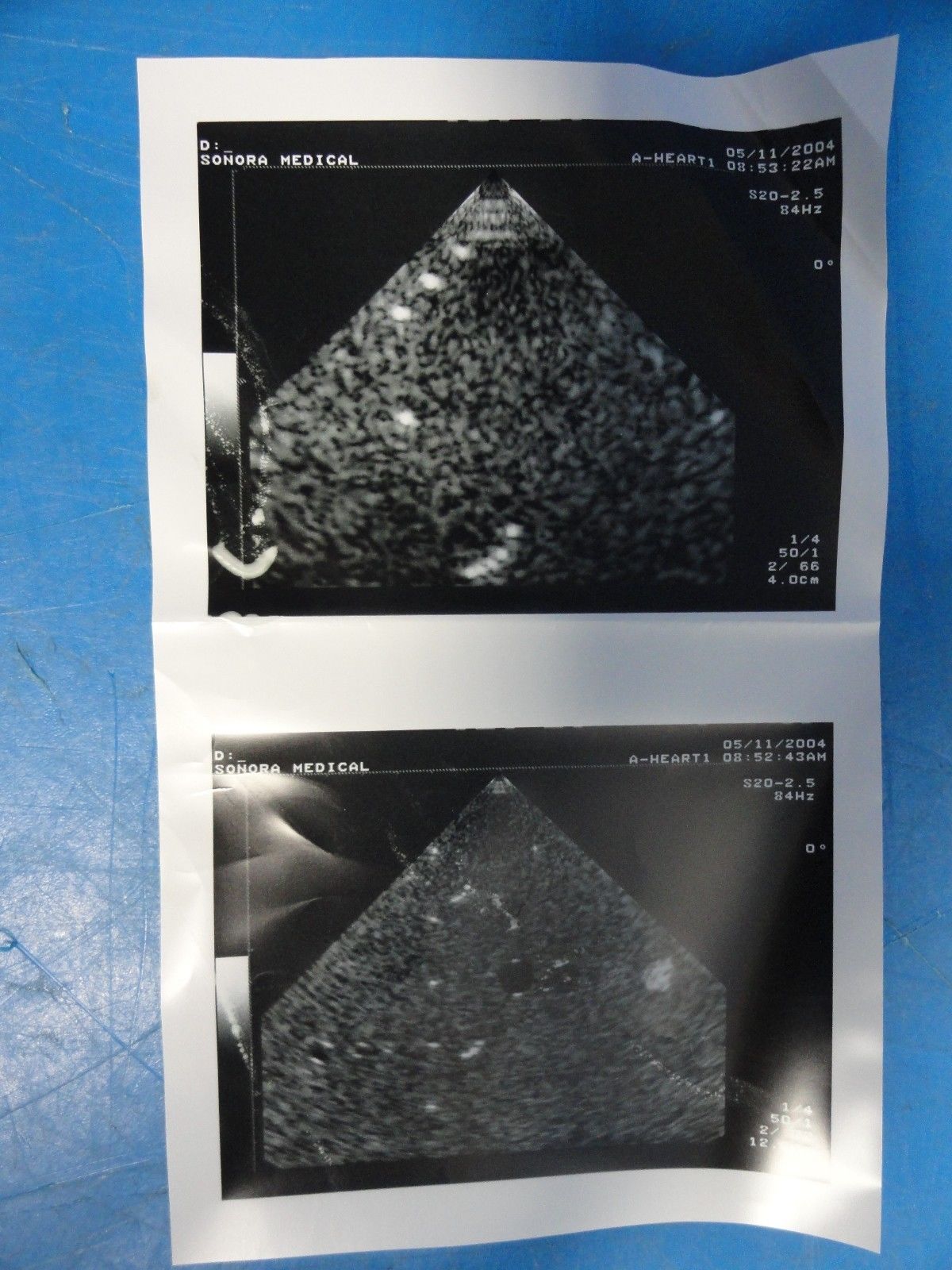 Toshiba PSK-20CT Phased Array Ultrasound Probe for SSA-380 & Powervision (7276) DIAGNOSTIC ULTRASOUND MACHINES FOR SALE