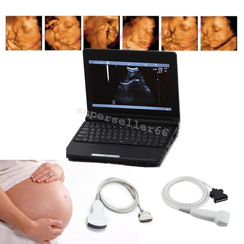Laptop LCD Ultrasound Scanner Diagnostic Ultrasonic Machine +Convex Linear Probe 190891743886 DIAGNOSTIC ULTRASOUND MACHINES FOR SALE