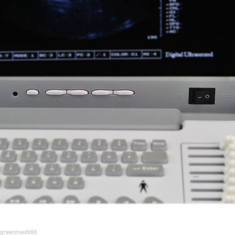 NEW Full Digital Portable Ultrasound Scanner with Transvaginal Probe 3D Software 190891050977 DIAGNOSTIC ULTRASOUND MACHINES FOR SALE