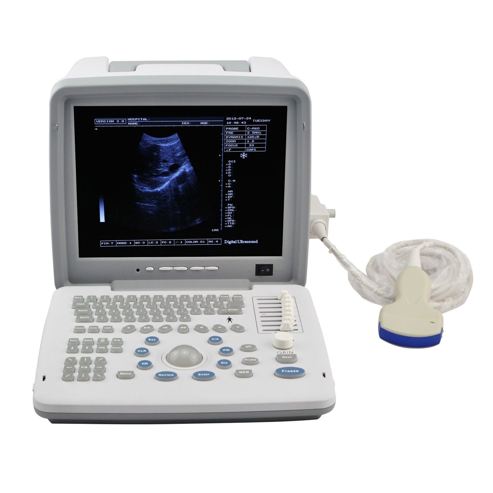 Portable Digital Ultrasound Machine Scanner System+ Convex + Linear Probe +3D CE 190891052384 DIAGNOSTIC ULTRASOUND MACHINES FOR SALE
