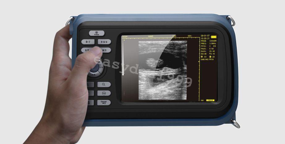 Mini Portable Handheld Digital Ultrasound Scanner + Convex + Transvaginal Probe DIAGNOSTIC ULTRASOUND MACHINES FOR SALE