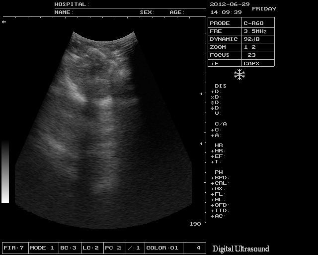 Digital Laptop Ultrasound Scanner Micro-Convex Probe External 3D Vet Veterinary 190891712110 DIAGNOSTIC ULTRASOUND MACHINES FOR SALE