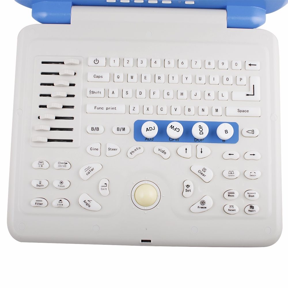 Full Digital Color Doppler Ultrasound Scanner Convex + Linear 2 Sensors/Probe A+ 190891277251 DIAGNOSTIC ULTRASOUND MACHINES FOR SALE
