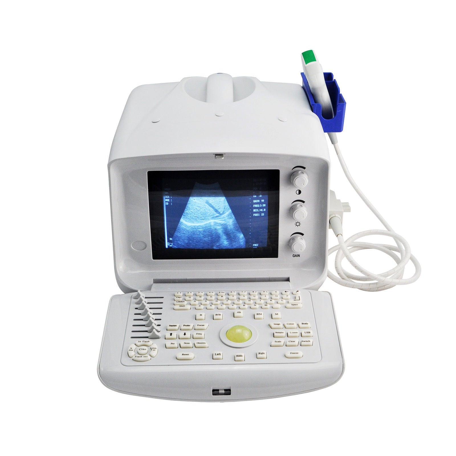Portable Digital Ultrasound Scanner Machine System 5.0MHz Micro Convex Probe 3D 190891303288 DIAGNOSTIC ULTRASOUND MACHINES FOR SALE