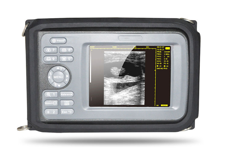 Laptop HandScan Digital Ultrasound Scanner system 7.5Mhz  Linear Probe + Case 190891758767 DIAGNOSTIC ULTRASOUND MACHINES FOR SALE