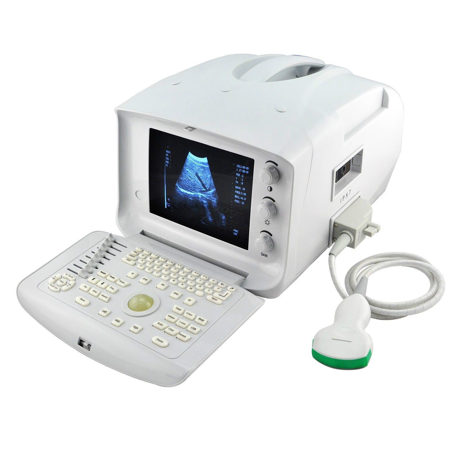 Medical 3D Portable Ultrasound Diagnose Scanner Convex Linear transvaginal Probe DIAGNOSTIC ULTRASOUND MACHINES FOR SALE