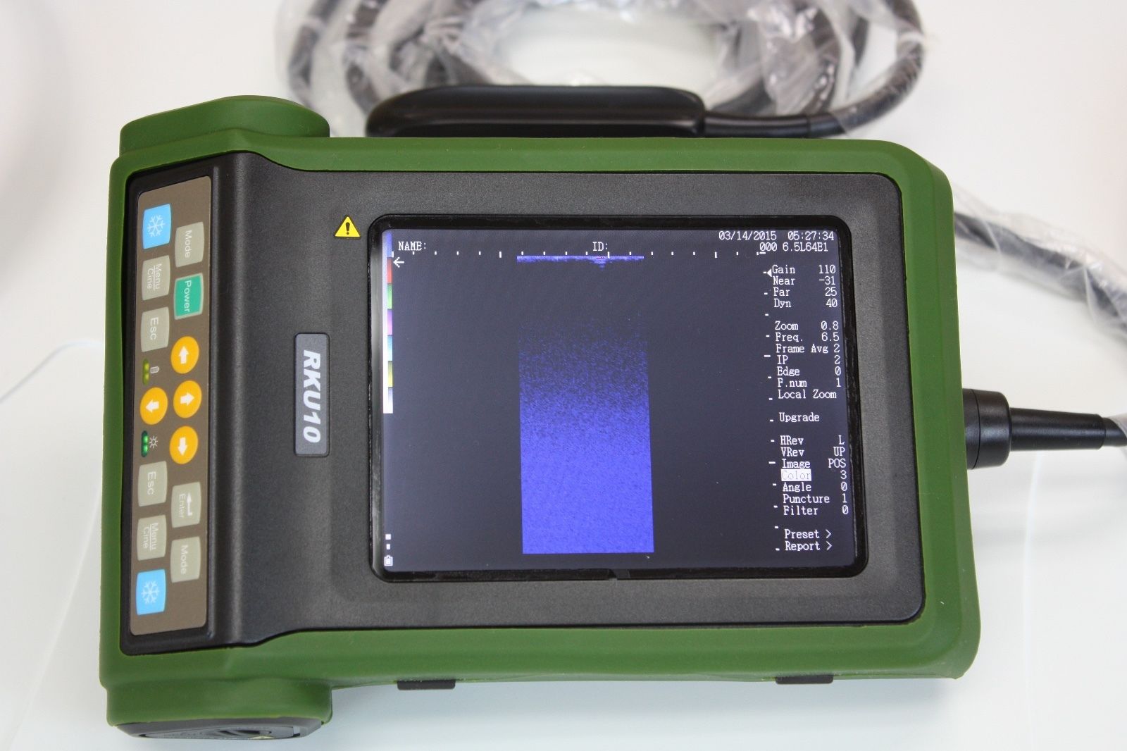 RKU-10 Best Veterinary Handheld Palm Ultrasound Scanner & Rectal Probe-KeeboMed DIAGNOSTIC ULTRASOUND MACHINES FOR SALE