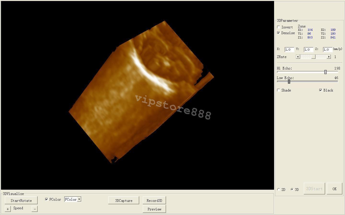Full Digital Laptop Ultrasound Scanner Linear 9000F + Free 3D Linear probe New DIAGNOSTIC ULTRASOUND MACHINES FOR SALE