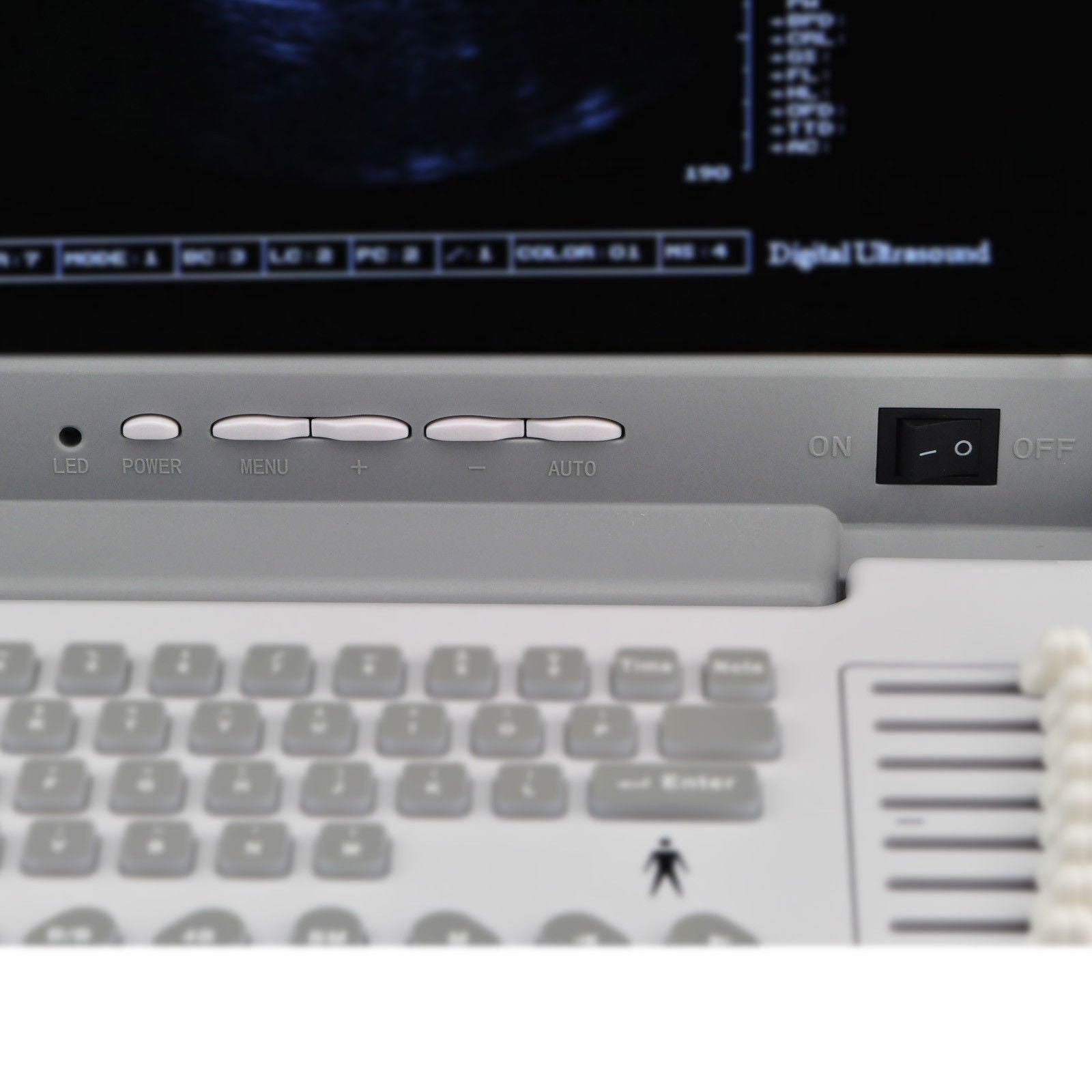 Digital Portable Ultrasound Scanner Machine + 7.5MHz Linear Probe 3D UPS Fast 190891523907 DIAGNOSTIC ULTRASOUND MACHINES FOR SALE