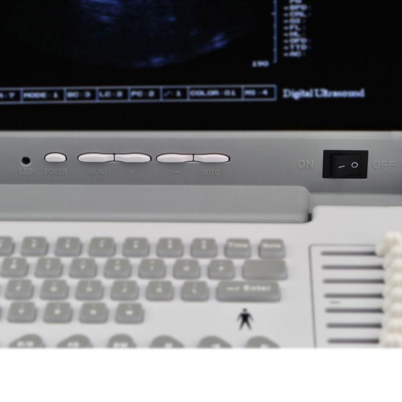 LCD Digital Ultrasound Scanner/Machine Convex Transvaginal Probes +3D Version CE 190891688125 DIAGNOSTIC ULTRASOUND MACHINES FOR SALE