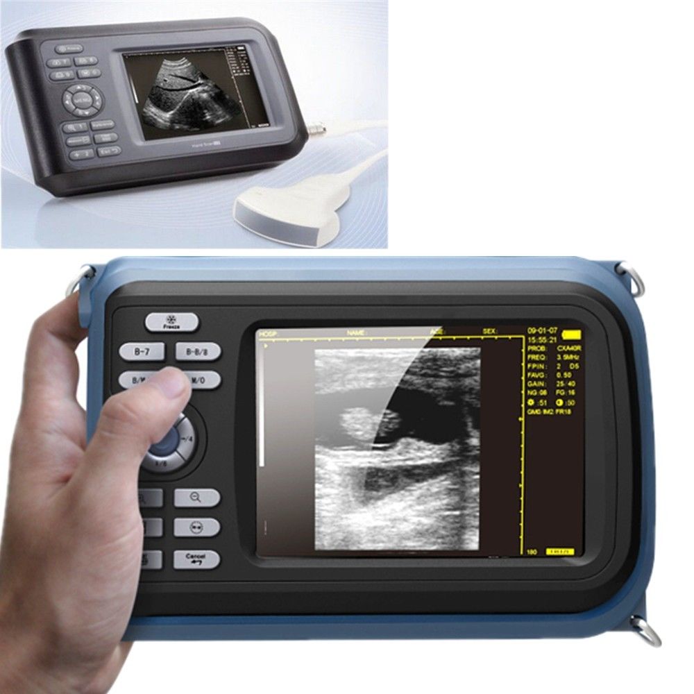 Laptop HandScan Digital Ultrasound Scanner system 7.5Mhz  Linear Probe + Case 190891758767 DIAGNOSTIC ULTRASOUND MACHINES FOR SALE