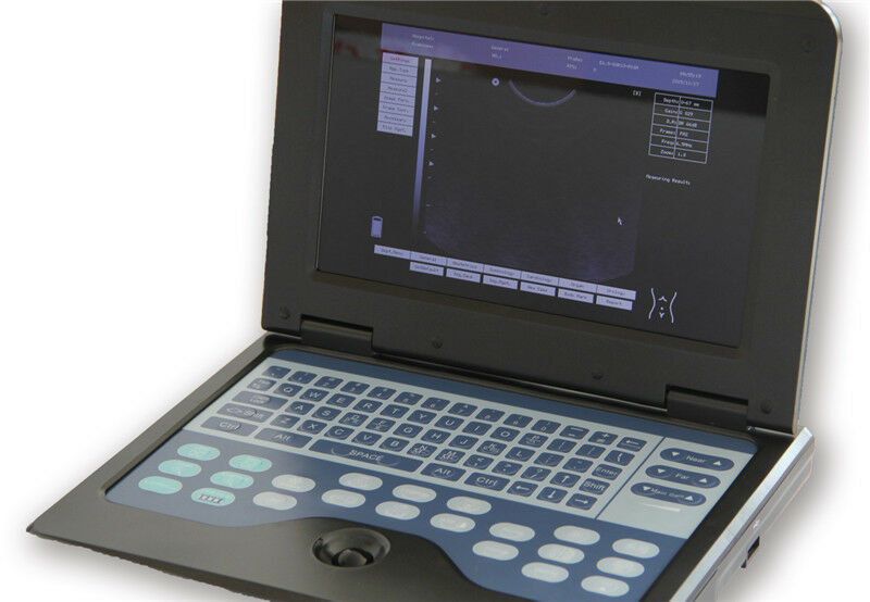 Portable Laptop Ultrasound Scanner Machine Digital Human Tranvaginal Probe DIAGNOSTIC ULTRASOUND MACHINES FOR SALE