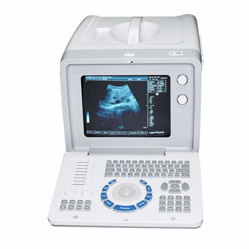 Portable 3D image Digital Ultrasound Scanner Linear Probe/Sensor B Ultrasound A+ DIAGNOSTIC ULTRASOUND MACHINES FOR SALE