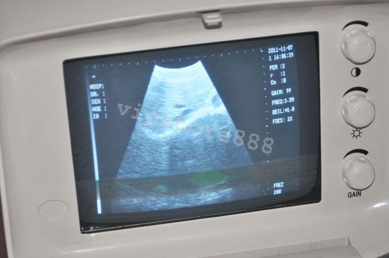 Digital Ultrasound Scanner Machine  +Convex +Vaginal + Linear 3 Probes/Sensor+3D DIAGNOSTIC ULTRASOUND MACHINES FOR SALE