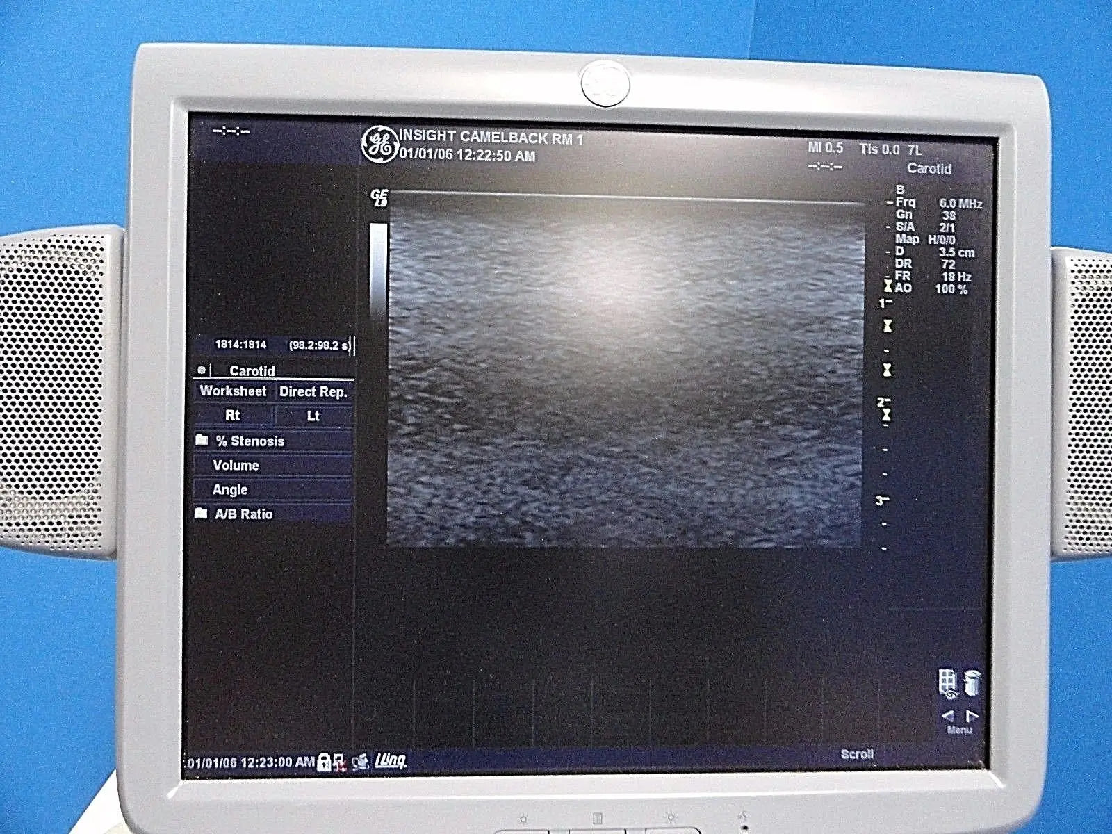 GE  7L / 2302648 Linear Array Ultrasound Probe for Logiq & Vivid Series~13787 DIAGNOSTIC ULTRASOUND MACHINES FOR SALE