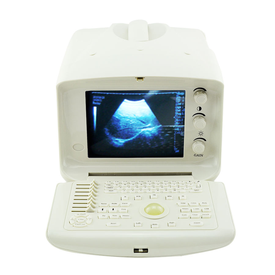 Diagnostic Ultrasound Scanner convex +linear probes external 3D system WARRANTY 190891613578 DIAGNOSTIC ULTRASOUND MACHINES FOR SALE
