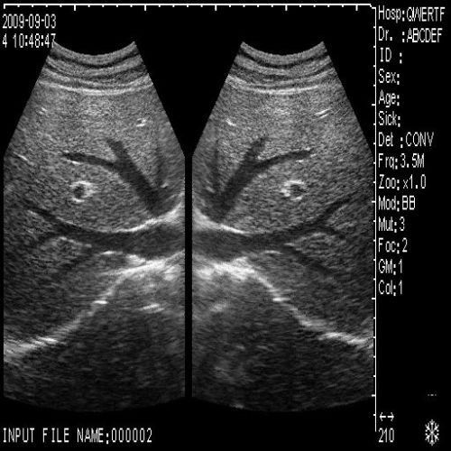 Diagnostic Ultrasound Scanner Machine Convex +Transvaginal 2 Probe 3D Scan Set A 190891393982 DIAGNOSTIC ULTRASOUND MACHINES FOR SALE