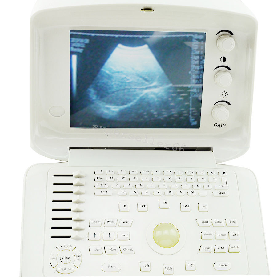 Digital LCD Ultrasound Scanner with convex & transvaginal probes & 3D RUS-6000A 190891562999 DIAGNOSTIC ULTRASOUND MACHINES FOR SALE