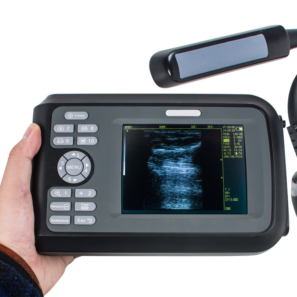 Factory Handheld PalmSmart Ultrasound Scanner/Machine Cardiac Micro-Convex Probe DIAGNOSTIC ULTRASOUND MACHINES FOR SALE