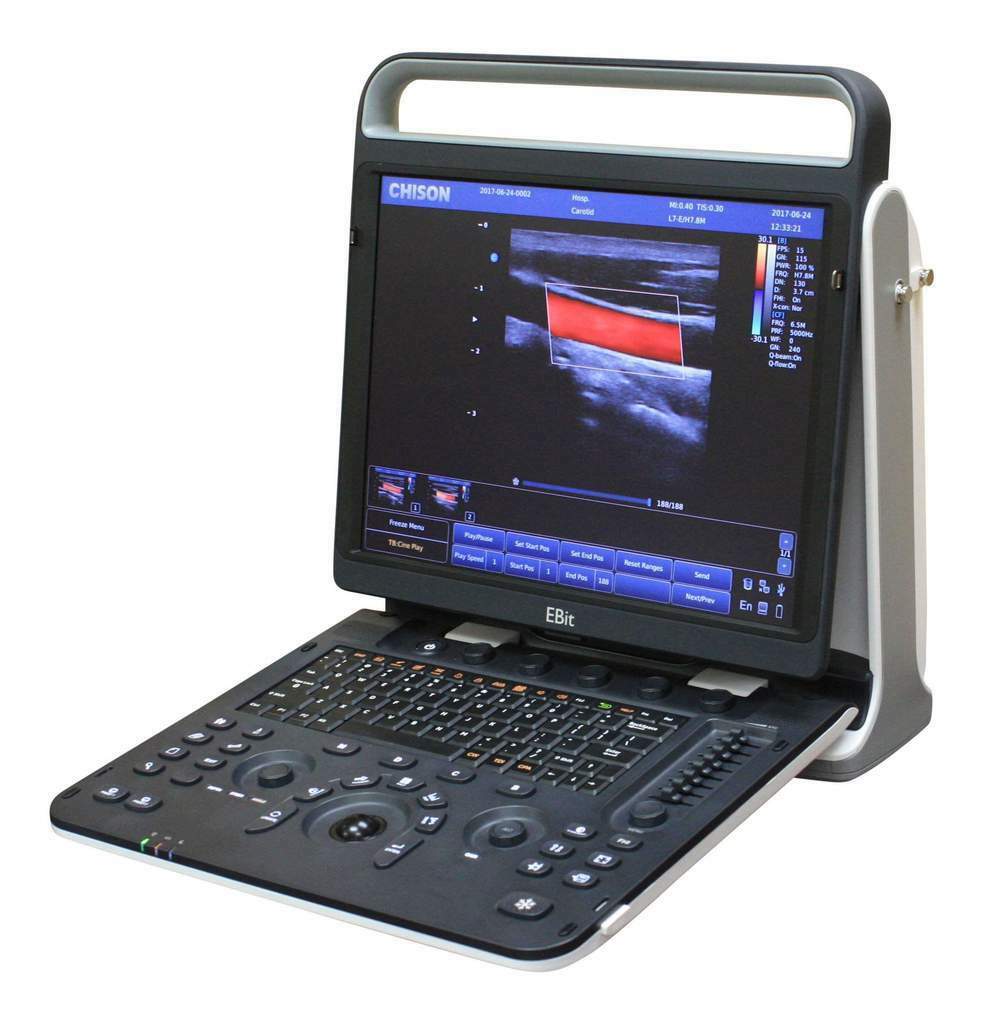 NEW Chison EBit 30 Portable Ultrasound System DIAGNOSTIC ULTRASOUND MACHINES FOR SALE