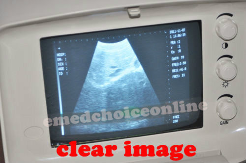Portable Machine Digital Ultrasound Scanner Transvaginal Probe -EXT 3D Software 190891982230 DIAGNOSTIC ULTRASOUND MACHINES FOR SALE