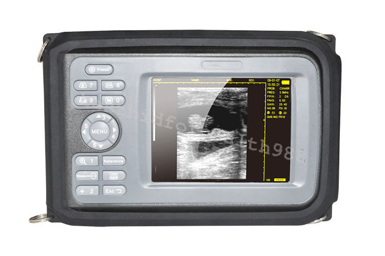 Palmtop Ultrasound Scanner Machine+Convex Probe+Box+ Battery 230mm×120mm×42mm DIAGNOSTIC ULTRASOUND MACHINES FOR SALE