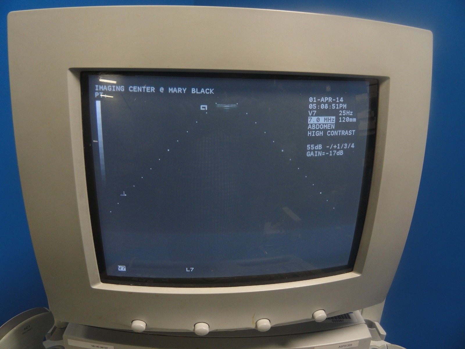 Acuson 7 Needle Guide V7 W/ Pins Ultrasound Probe for Acuson XP & ASPEN (6550) DIAGNOSTIC ULTRASOUND MACHINES FOR SALE