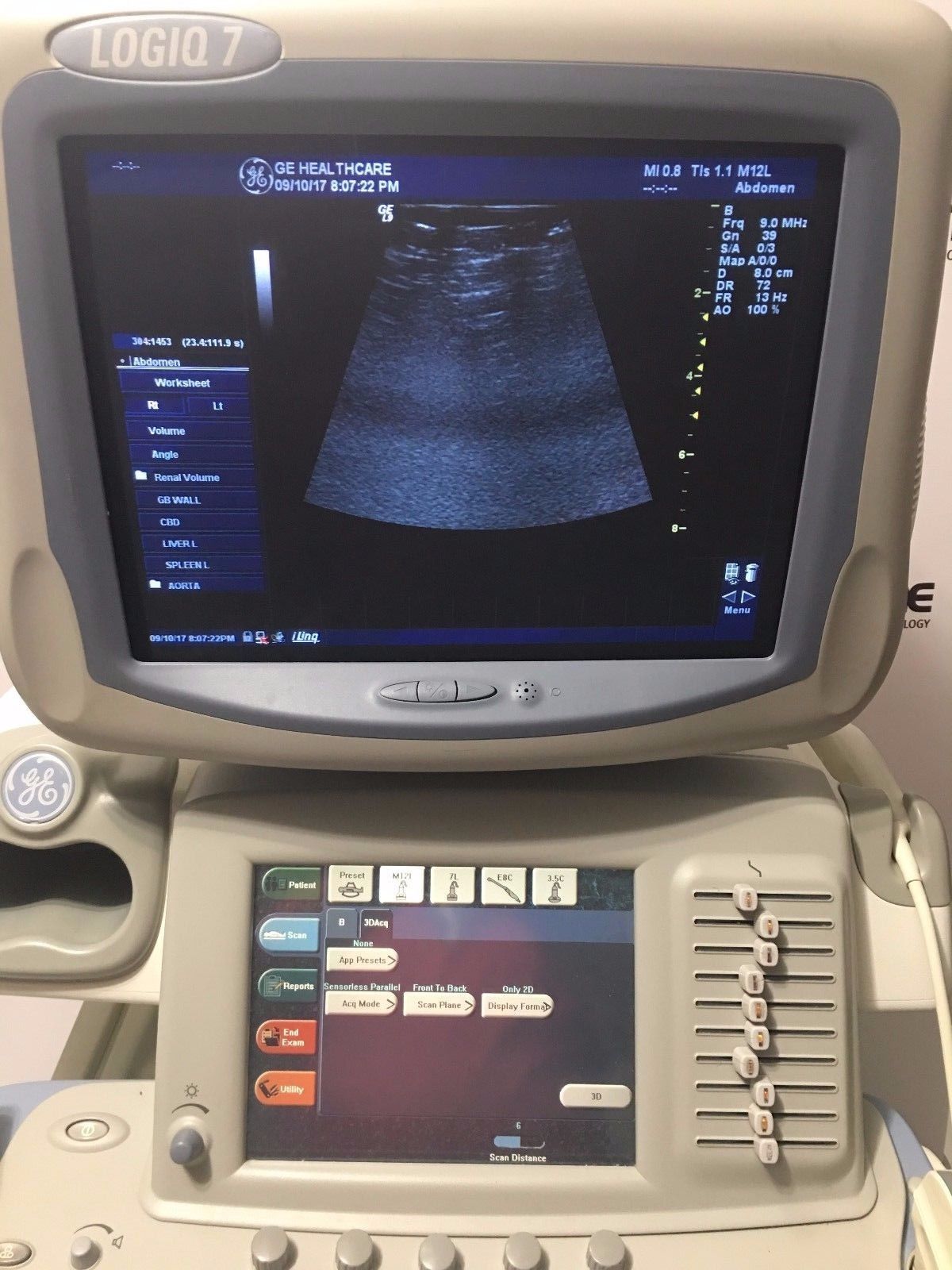 GE Logiq 9 Ultrasound System with 3.5C, E8C, 7L, 10L, and M12L  Transducers DIAGNOSTIC ULTRASOUND MACHINES FOR SALE