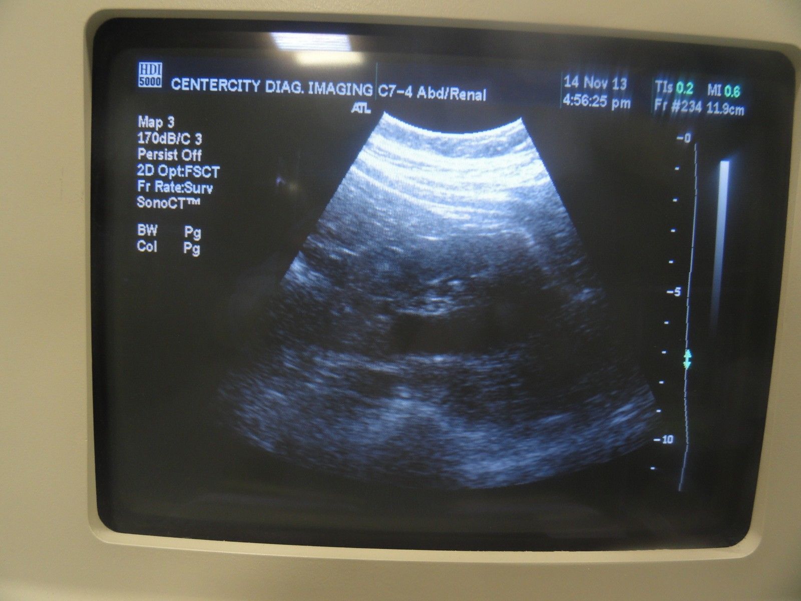 ATL C7-4 40R Curved Array Convex Abdominal  Probe for ATL HDI Series  (5965 ) DIAGNOSTIC ULTRASOUND MACHINES FOR SALE