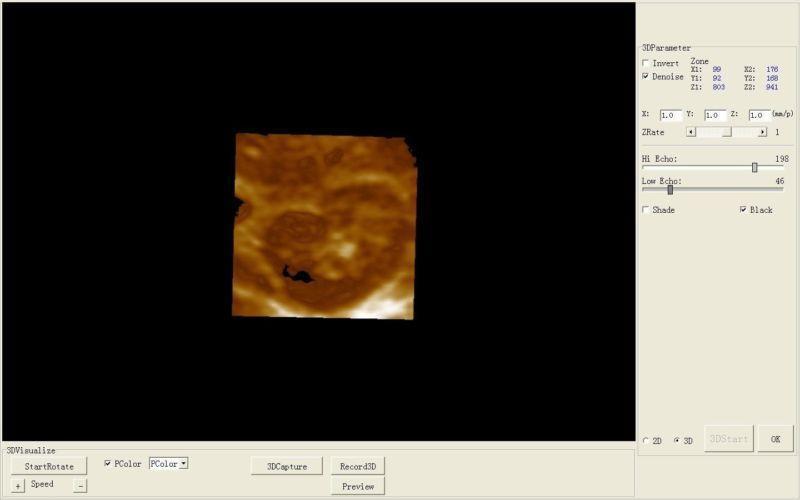 Free 3D 10'' LCD Digital Ultrasound Scanner +Convex +Transvaginal Probe 6000A FF DIAGNOSTIC ULTRASOUND MACHINES FOR SALE