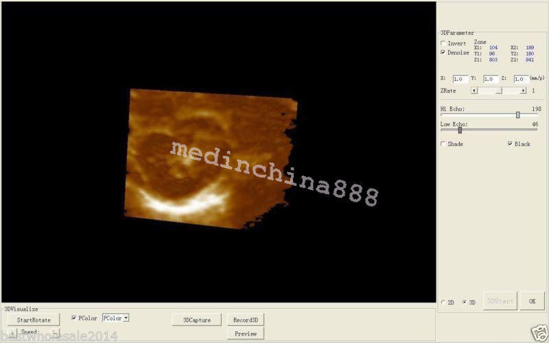 Digital LCD Ultrasound Scanner Machine+Convex + Linear Probe+Sony Printer 190891246417 DIAGNOSTIC ULTRASOUND MACHINES FOR SALE
