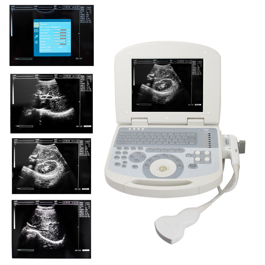 Portable Full Digital Laptop 10.4" Medical Ultrasound Scanner 3.5 Convex probe DIAGNOSTIC ULTRASOUND MACHINES FOR SALE