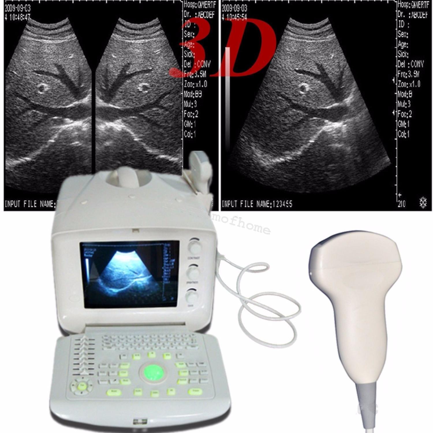 Full Digital Portable Ultrasound Scanner machine +Convex + Vignial  2 Probes+3D DIAGNOSTIC ULTRASOUND MACHINES FOR SALE