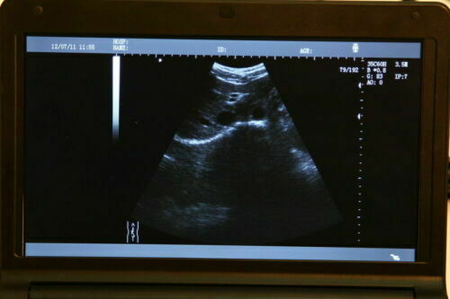Laptop Ultrasound Scanner Machine+Transvaginal Probe+Micro Convex Probe ON SALE DIAGNOSTIC ULTRASOUND MACHINES FOR SALE